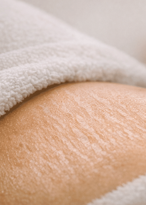 littekenherstel majestic skin majestic skin littekenherstel